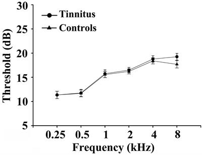 Chronic Tinnitus Exhibits Bidirectional Functional Dysconnectivity in Frontostriatal Circuit